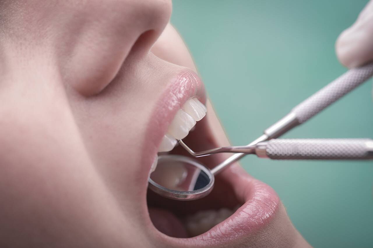¿Qué son las lesiones de la cavidad oral?
