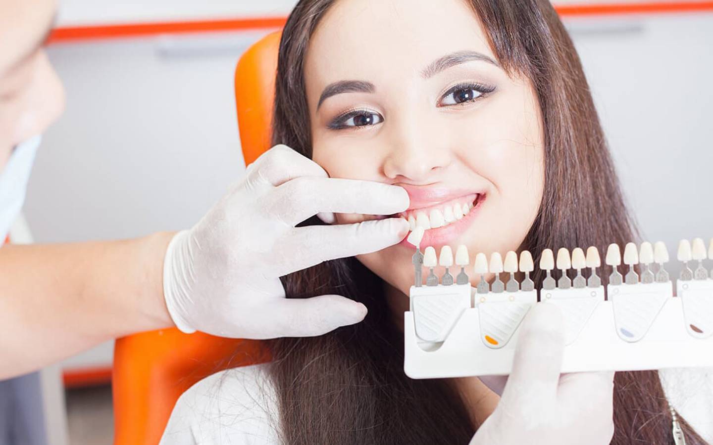 Diseño de sonrisa