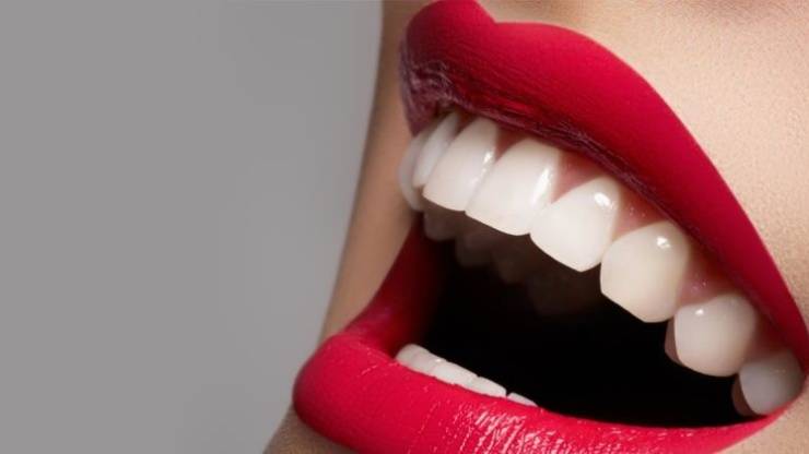 Blancorexia: la obsesión por los dientes blancos