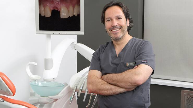 Conoce los diferentes tipos de implantes dentales